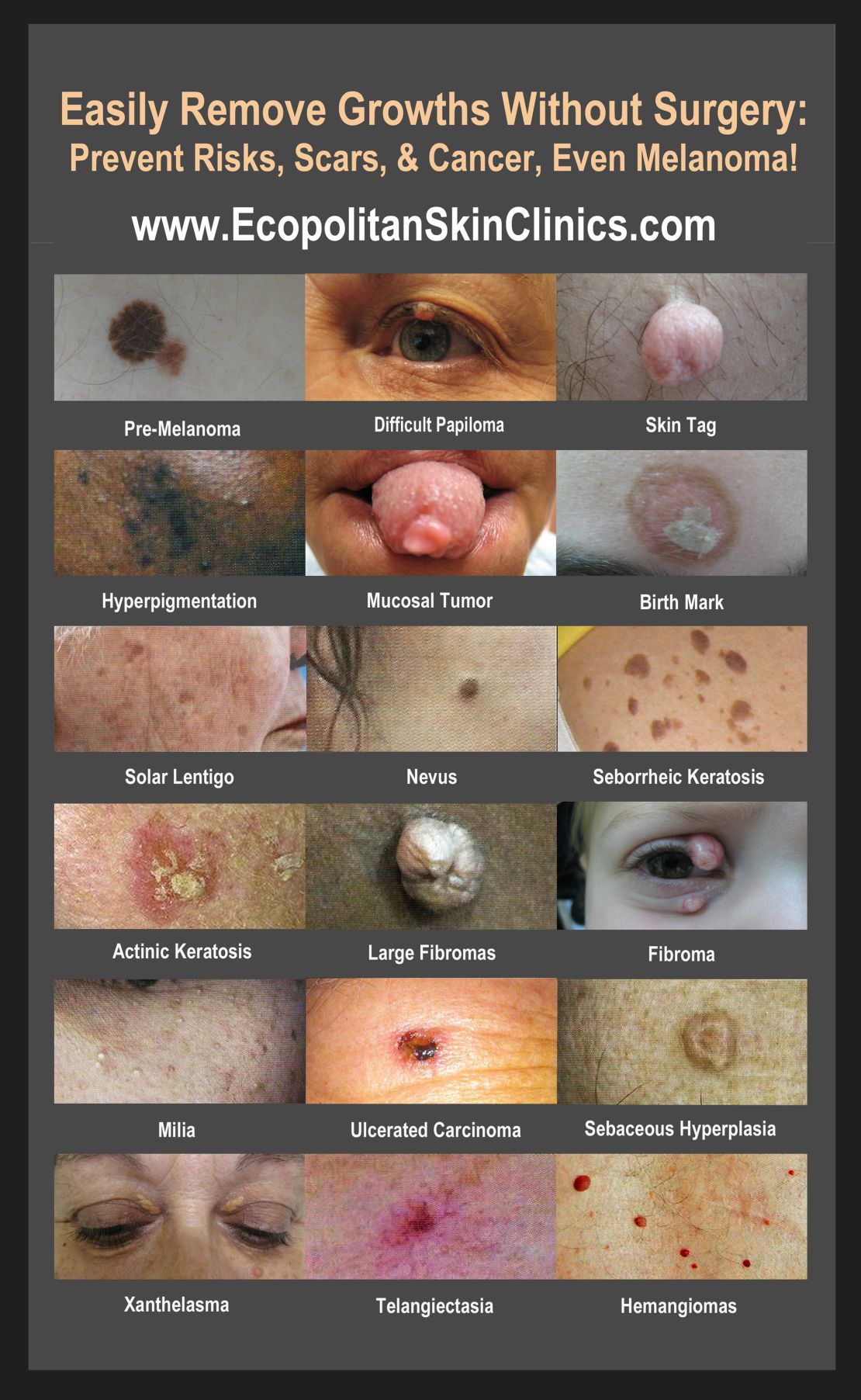 Ecopolitan Skin Clinics example of skin lesions